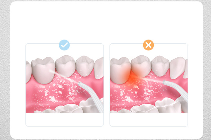 Irigator Oral 3 Moduri De Lucru, 4 capete , Portabil, Rezervor 220 Ml